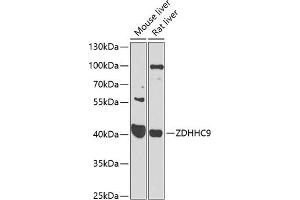 Western blot analysis of extracts of various cell lines, using ZDHHC9 antibody (ABIN6131130, ABIN6150420, ABIN6150421 and ABIN6223988) at 1:1000 dilution. (ZDHHC9 抗体  (AA 250-364))