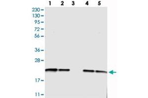 Western blot analysis of Lane 1: RT-4, Lane 2: U-251 MG, Lane 3: Human Plasma, Lane 4: Liver, Lane 5: Tonsil with C6orf108 polyclonal antibody  at 1:250-1:500 dilution. (RCL 抗体)
