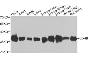 Western blot analysis of extracts of various cell lines, using LDHB antibody (ABIN5975613) at 1/1000 dilution. (LDHB 抗体)
