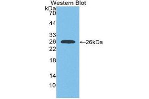 Western Blotting (WB) image for anti-Insulin-Like Growth Factor 1 Receptor (IGF1R) (AA 763-955) antibody (ABIN3206269) (IGF1R 抗体  (AA 763-955))