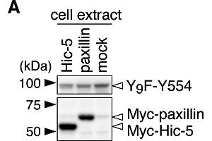 Git1 phosphorylation at Tyr-554 was enhanced by co-expression of paxillin. (Myc Tag 抗体)