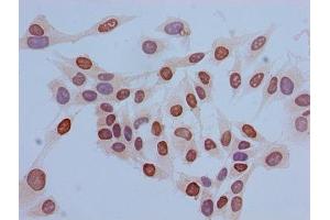 Immunocytochemistry analysis of Hela cells using ABIN7139669 at dilution of 1:100 (HIST1H3A 抗体  (3meLys36))