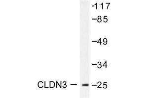 Image no. 2 for anti-Claudin 3 (CLDN3) antibody (ABIN265362) (Claudin 3 抗体)
