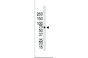 Western Blotting (WB) image for anti-Bone Morphogenetic Protein Receptor, Type IB (BMPR1B) (AA 472-502), (C-Term) antibody (ABIN388739)