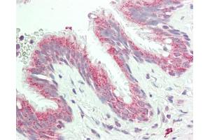 Human Lung: Formalin-Fixed, Paraffin-Embedded (FFPE). (AREL1 抗体  (AA 179-228))