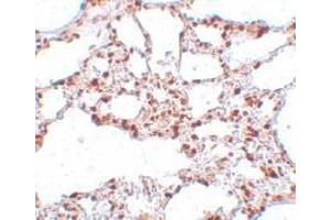 Immunohistochemistry of ZSCAN4 in rat lung tissue with this product at 5 μg/ml. (ZSCAN4 抗体  (C-Term))