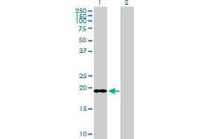 Western Blot analysis of ICT1 expression in transfected 293T cell line by ICT1 MaxPab polyclonal antibody. (ICT1 抗体  (AA 1-206))