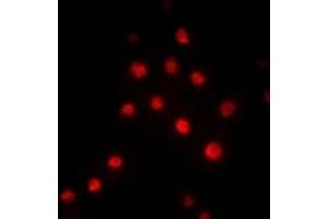 Immunofluorescent analysis of RBBP5 staining in Hela cells. (RBBP5 抗体)