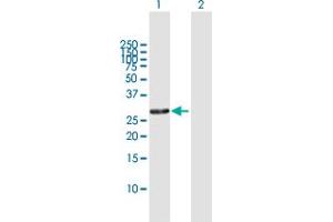 Western Blot analysis of RPA4 expression in transfected 293T cell line by RPA4 MaxPab polyclonal antibody. (RPA4 抗体  (AA 1-261))
