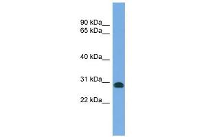 CENPH antibody used at 1 ug/ml to detect target protein. (CENPH 抗体  (N-Term))
