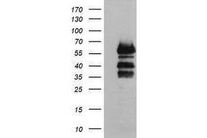Image no. 1 for anti-Vasodilator-Stimulated phosphoprotein (VASP) antibody (ABIN1501697) (VASP 抗体)