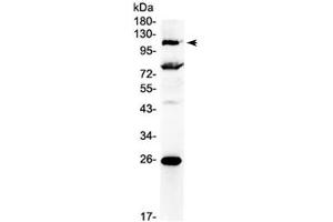 Western blot testing of human 22RV1 cell lysate with NFAT4 antibody at 0. (NFATC3 抗体)
