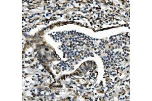IHC analysis of CDC27 using anti-CDC27 antibody (ABIN7602163).