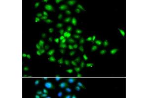 Immunofluorescence analysis of MCF-7 cells using SBDS Polyclonal Antibody (SBDS 抗体)