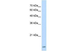 WB Suggested Anti-UBE2I Antibody Titration:  2. (UBE2I 抗体  (Middle Region))