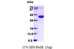 Superoxide dismutase copper chaperone Protein (AA 1-274) (His tag)