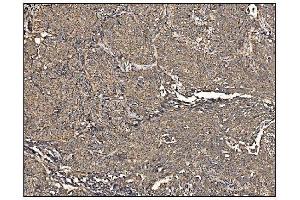 IHC analysis of Arginine Decarboxylase/AZIN2 using anti-Arginine Decarboxylase/AZIN2 antibody (ABIN7599403). (ADC 抗体  (AA 1-448))