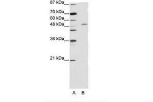 Image no. 1 for anti-Zinc Finger and SCAN Domain Containing 25 (ZSCAN25) (C-Term) antibody (ABIN203159) (Zinc Finger and SCAN Domain Containing 25 (ZSCAN25) (C-Term) 抗体)