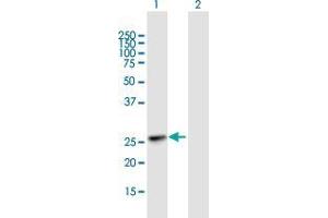 Western Blot analysis of KIAA1109 expression in transfected 293T cell line by KIAA1109 MaxPab polyclonal antibody. (Fetal Sulfoslycoprotein Antigen (FSA) (AA 1-191) 抗体)