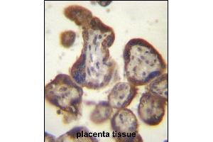 CGB/HCG-Beta Antibody (C-term) (ABIN656960 and ABIN2846144) immunohistochemistry analysis in formalin fixed and paraffin embedded human placenta tissue followed by peroxidase conjugation of the secondary antibody and DAB staining. (CGB 抗体  (C-Term))