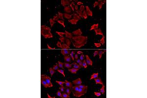 Immunofluorescence analysis of HeLa cell using TCAP antibody. (TCAP 抗体)