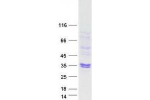 Western Blotting (WB) image for Superoxide Dismutase 3, Extracellular (SOD3) protein (Myc-DYKDDDDK Tag) (ABIN2732998)