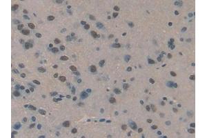 DAB staining on IHC-P; Samples: Rat Brain Tissue (SERPIND1 抗体  (AA 25-235))
