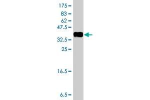 Western Blot detection against Immunogen (36. (TIAM2 抗体  (AA 527-624))