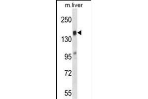 TI Antibody (N-term) (ABIN657533 and ABIN2846551) western blot analysis in mouse liver tissue lysates (35 μg/lane). (TIAM2 抗体  (AA 357-385))