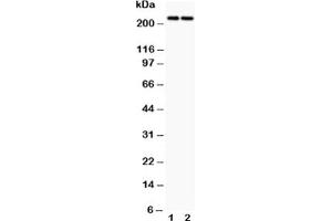 Western blot testing of Dicer antibody and Lane 1:  HeLa;  2: MCF-7 (DICER1 抗体  (AA 1-195))