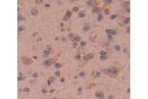 Immunohistochemistry (IHC) image for anti-Macrophage Migration Inhibitory Factor (Glycosylation-Inhibiting Factor) (MIF) (AA 4-112) antibody (ABIN1859826)