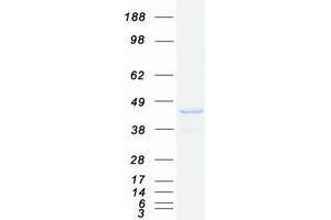SNX16 Protein (Transcript Variant 2) (Myc-DYKDDDDK Tag)