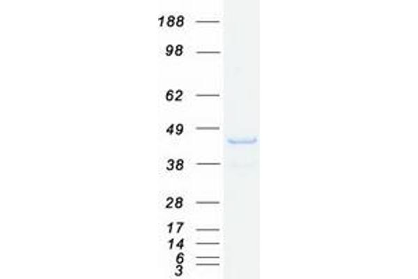 SNX16 Protein (Transcript Variant 2) (Myc-DYKDDDDK Tag)