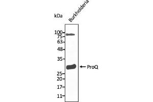 Western Blotting (WB) image for anti-ProQ antibody (ABIN7272983) (ProQ 抗体)