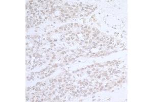 anti-RNA Polymerase-Associated Protein CTR9 Homolog (CTR9) (AA 1123-1173) antibody
