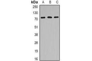 Western blot analysis of HSPA6 expression in Jurkat (A), mouse heart (B), rat brain (C) whole cell lysates. (HSPA6 抗体)