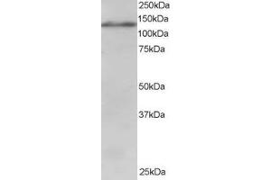 ABIN185009 staining (1µg/ml) of Jurkat lysate (RIPA buffer, 30µg total protein per lane). (USP11 抗体  (C-Term))