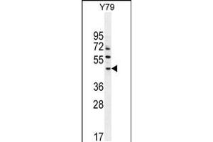 Western blot analysis in Y79 cell line lysates (35ug/lane). (LACE1 抗体  (N-Term))