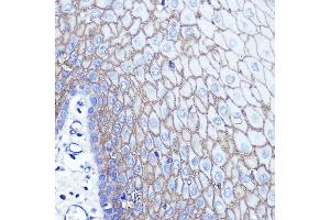 Immunohistochemistry of paraffin-embedded human esophageal using S100 Rabbit pAb (ABIN6128693, ABIN6147339, ABIN6147340 and ABIN6214636) at dilution of 1:100 (40x lens). (S100A14 抗体  (AA 1-104))