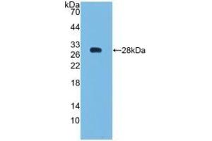 Detection of Recombinant Bcl2, Human using Polyclonal Antibody to B-Cell Leukemia/Lymphoma 2 (Bcl2)