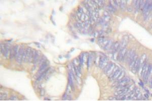Image no. 1 for anti-Somatostatin (SST) antibody (ABIN271820) (Somatostatin 抗体)