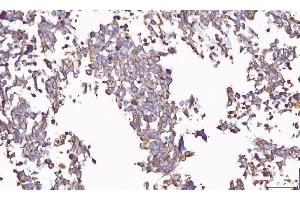 IHC analysis of PP11/ENDOU using anti-PP11/ENDOU antibody (ABIN7600552). (ENDOU 抗体  (AA 20-386))