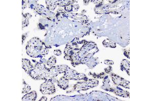 IHC analysis of splicing factor 1 using anti-splicing factor 1 antibody . (Splicing Factor 1 抗体  (AA 160-266))