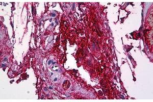 Human Intravascular Plasma: Formalin-Fixed, Paraffin-Embedded (FFPE) (FGG 抗体  (AA 31-130))