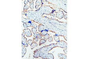 IHC analysis of EGFR using anti-EGFR antibody (ABIN5518909). (EGFR 抗体  (N-Term))