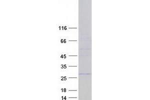 Western Blotting (WB) image for RAB37, Member RAS Oncogene Family (RAB37) (Transcript Variant 5) protein (Myc-DYKDDDDK Tag) (ABIN2730344)