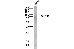 Lane 1: Tev-1 lysates probed with C1orf113 Polyclonal Antibody  at 1:300 overnight at 4˚C. (SH3D21 抗体  (AA 51-150))