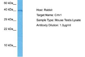 Host: Mouse Target Name: CRHR1 Sample Tissue: Mouse Testis Antibody Dilution: 1ug/ml (CRHR1 抗体  (C-Term))