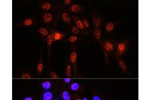 Immunofluorescence analysis of NIH-3T3 cells using Phospho-YAP1(S127) Polyclonal Antibody at dilution of 1:100 (40x lens). (YAP1 抗体  (pSer127))