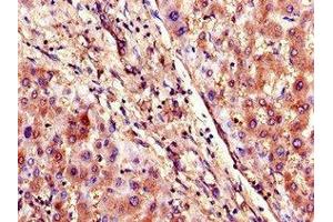 Immunohistochemistry of paraffin-embedded human liver tissue using ABIN7170291 at dilution of 1:100 (SLCO1B3 抗体  (AA 648-695))